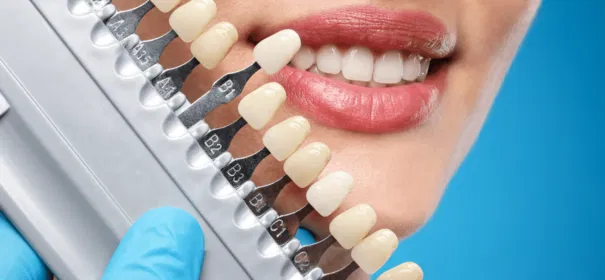 Smile Design: Where Art Meets Confidence